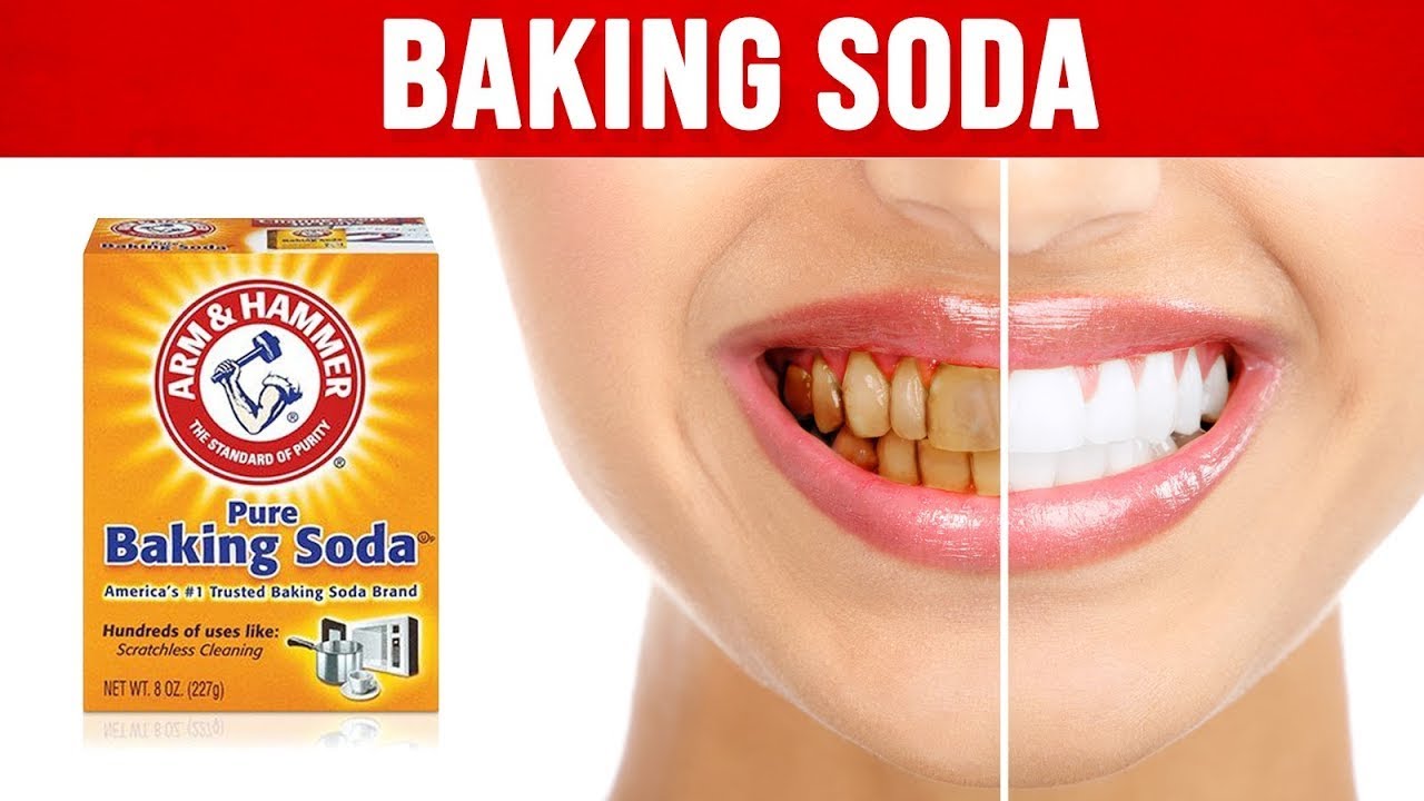 8 cách làm trắng răng bằng baking soda cùng nha khoa B.F+