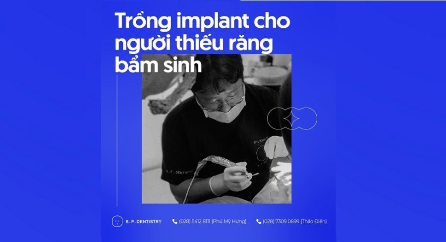 Trong Rang Implant Cho Nguoi Thieu Rang Bam Sinh 1